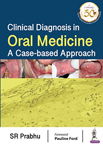 Clinical Diagnosis in Oral Medicine: A Case-based Approach (Original PDF from Publisher)