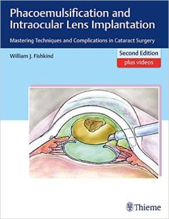 Phacoemulsification and Intraocular Lens Implantation: Mastering Techniques and Complications in Cataract Surgery, 2nd Edition (Original PDF from Publisher)