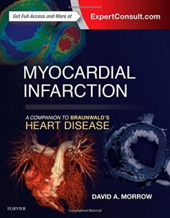 Myocardial Infarction: A Companion to Braunwald’s Heart Disease (Original PDF from Publisher)