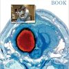 The NeuroICU Book, Second Edition (EPUB)