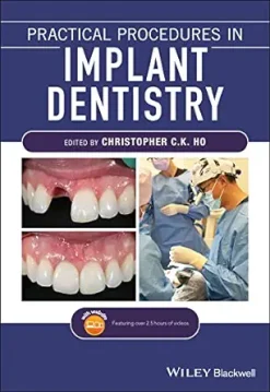 Practical Procedures in Implant Dentistry (EPUB)