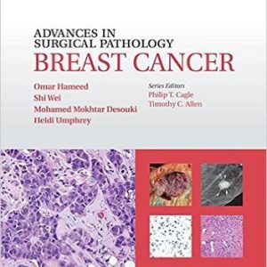 Advances in Surgical Pathology: Breast Cancer (EPUB)