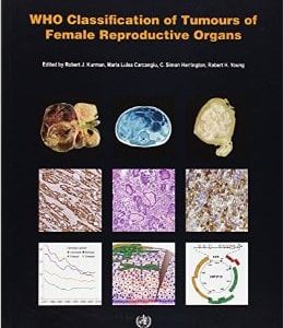 WHO Classification of Tumours of the Female Reproductive Organs (IARC WHO Classification of Tumours) (Retail PDF)