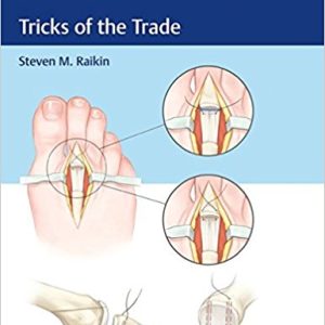 Foot and Ankle Surgery: Tricks of the Trade 1st Edition (Original PDF from Publisher)