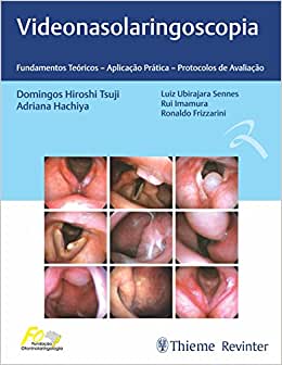 Videonasolaringoscopia: Fundamentos Teóricos – Aplicação Prática – Protocolos de Avaliação, 1ª edição (Original PDF from Publisher)