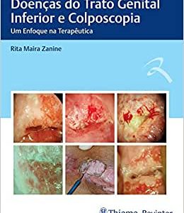 Doenças do Trato Genital Inferior e Colposcopia: Um Enfoque na Terapêutica (Original PDF from Publisher)