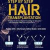 Step by Step Hair Transplantation (Original PDF from Publisher)