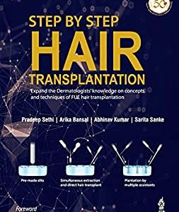 Step by Step Hair Transplantation (Original PDF from Publisher)