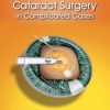 Cataract Surgery in Complicated Cases (ORIGINAL PDF from Publisher)
