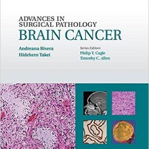Advances in Surgical Pathology: Brain Cancer (EPUB)