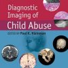 [PREMUIM]Diagnostic Imaging of Child Abuse, 3e