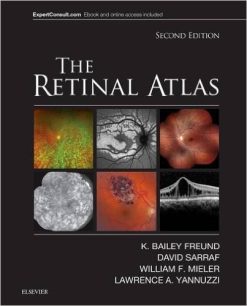 The Retinal Atlas, 2nd Edition