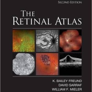 The Retinal Atlas, 2nd Edition