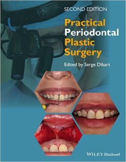 Practical Periodontal Plastic Surgery, 2nd Edition (ePUB)