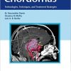 Chordomas: Technologies, Techniques, and Treatment Strategies (Original PDF from Publisher)