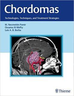 Chordomas: Technologies, Techniques, and Treatment Strategies (Original PDF from Publisher)