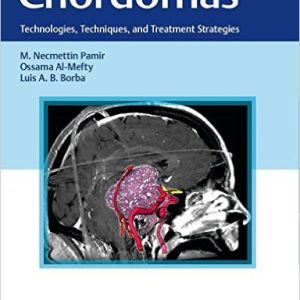 Chordomas: Technologies, Techniques, and Treatment Strategies (Original PDF from Publisher)