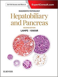 Diagnostic Pathology: Hepatobiliary and Pancreas E-Book, 2nd Edition (PDF)