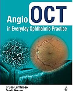 Angio OCT in Everyday Ophthalmic Practice (Original PDF from Publisher)
