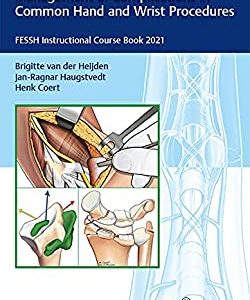 Management of Complications in Common Hand and Wrist Procedures: FESSH Instructional Course Book 2021 (Original PDF From Publisher)