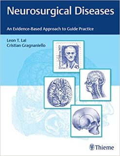 Neurosurgical Diseases: An Evidence-Based Approach to Guide Practice (Original PDF from Publisher)