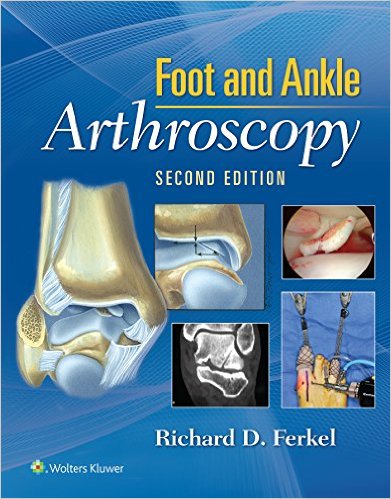 Foot & Ankle Arthroscopy, 2nd Edition (EPUB)