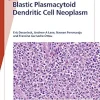 Fast Facts: Blastic Plasmacytoid Dendritic Cell Neoplasm: Shedding Light on a Rare Disease (Original PDF from Publisher)