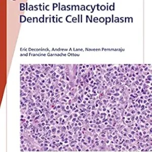 Fast Facts: Blastic Plasmacytoid Dendritic Cell Neoplasm: Shedding Light on a Rare Disease (EPUB)
