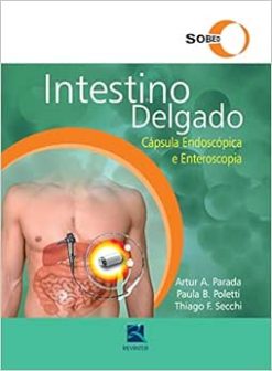 SOBED Intestino delgado: Cápsula Endoscópica e Enteroscopia, 1st Edition (EPUB)