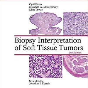 Biopsy Interpretation of Soft Tissue Tumors, Second Edition (EPUB)