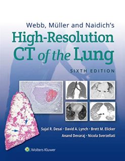Webb, Müller and Naidich’s High-Resolution CT of the Lung, 6ed (ePub+azw3+Converted PDF)