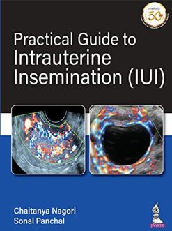 Practical Guide To Intrauterine Insemination (IUI) (Original PDF from Publisher)