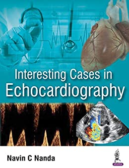 Interesting Cases in Echocardiography (Original PDF from Publisher)