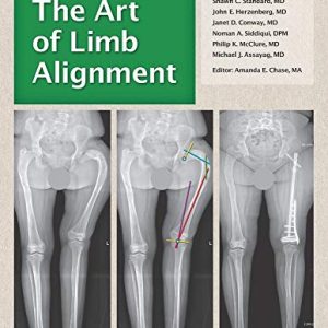 The Art of Limb Alignment, Ninth Edition (Original PDF from Publisher)