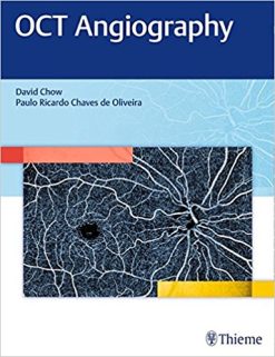 OCT Angiography (EPUB)