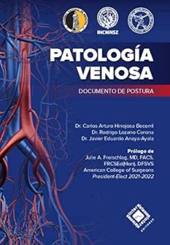 Patología Venosa (Spanish Edition) (EPUB)
