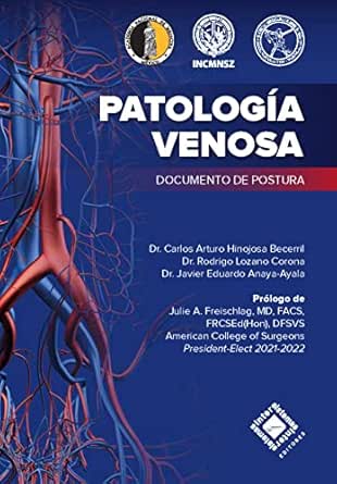 Patología Venosa (Spanish Edition) (EPUB)