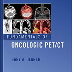 Fundamentals of Oncologic PET/CT (Fundamentals of Radiology) (PDF)