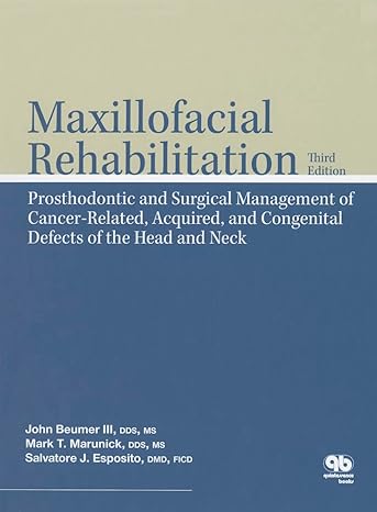 Maxillofacial Rehabilitation: Prosthodontic and Surgical Management of Cancer-Related, Acquired, and Congenital Defects of the Head and Neck, 3rd Edition (Scanned PDF)
