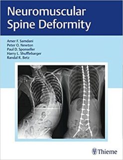 Neuromuscular Spine Deformity 1st Edition (Original PDF from Publisher)