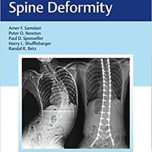 Neuromuscular Spine Deformity 1st Edition (Original PDF from Publisher)