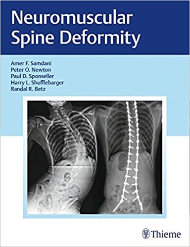 Neuromuscular Spine Deformity 1st Edition (Original PDF from Publisher)