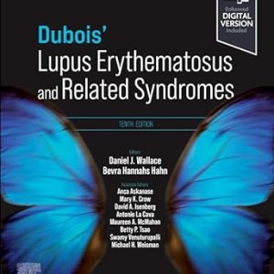 Dubois’ Lupus Erythematosus and Related Syndromes, 10th edition (ePub+Converted PDF)
