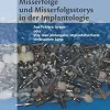 Misserfolge und Misserfolgsstorys in der Implantologie: Aus Fehlern lernen oder Wie man ahnungslos Implantatverluste verursachen kann (German Edition) (EPUB)