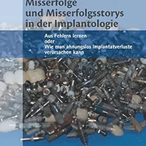 Misserfolge und Misserfolgsstorys in der Implantologie: Aus Fehlern lernen oder Wie man ahnungslos Implantatverluste verursachen kann (German Edition) (EPUB)