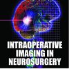 Intraoperative Imaging in Neurosurgery (Original PDF from Publisher)