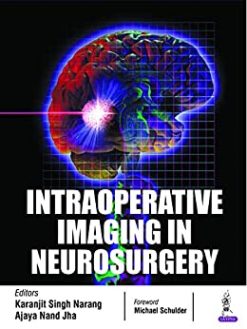 Intraoperative Imaging in Neurosurgery (Original PDF from Publisher)