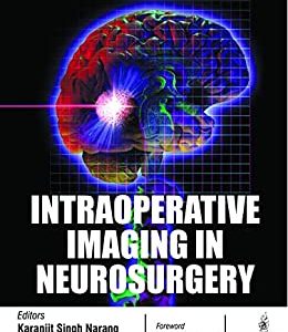 Intraoperative Imaging in Neurosurgery (Original PDF from Publisher)