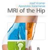 MRI of the Hip (Original PDF from Publisher)