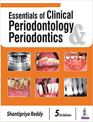 Essentials of Clinical Periodontology and Periodontics 5th Edition (Original PDF from Publisher)